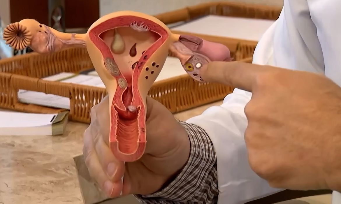 Edital do CNPq incentiva pesquisas sobre endometriose e saúde da mulher