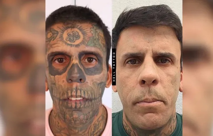 Homem Mais Tatuado do Brasil: Saiba Tudo Sobre o Diagnóstico de Tumor na Bexiga